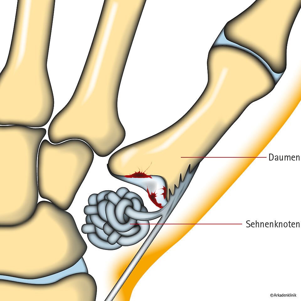 Detail Daumen Anatomie Bild Nomer 6