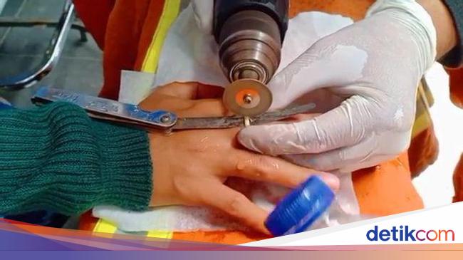 Detail Alat Pemotong Cincin Di Jari Nomer 23