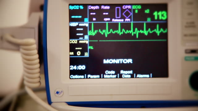 Detail Alat Pendeteksi Detak Jantung Di Rumah Sakit Nomer 21