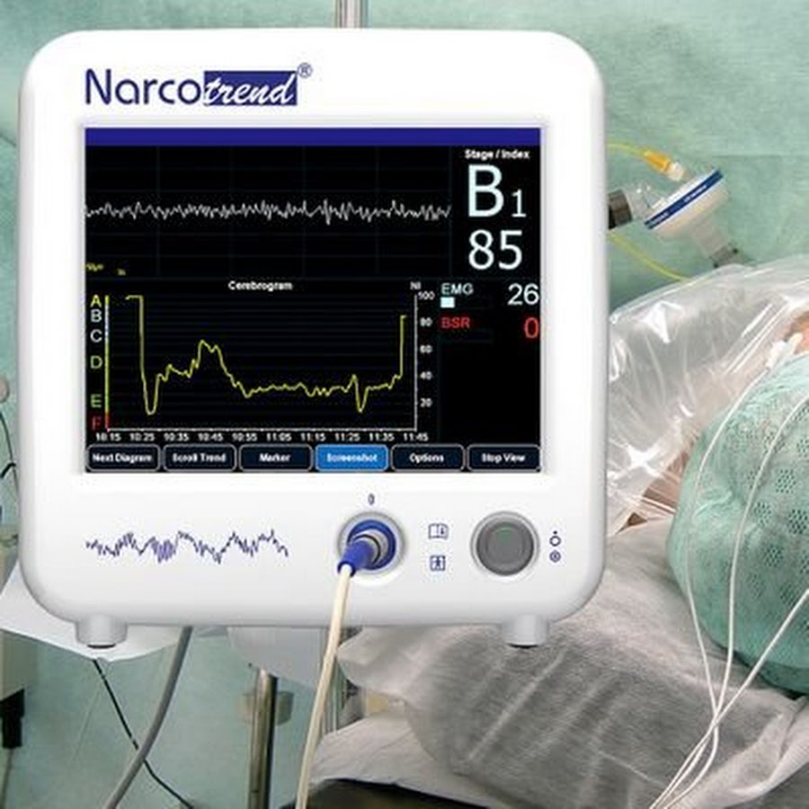 Detail Alat Pendeteksi Detak Jantung Di Rumah Sakit Nomer 25