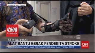 Detail Alat Terapi Stroke Di Rumah Nomer 32