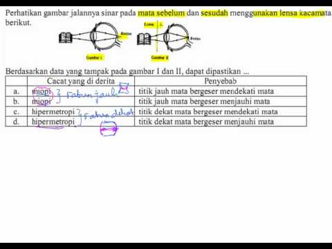 Detail Gambar Cacat Mata Nomer 53