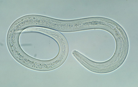 Detail Gambar Cacing Larva Tambang Nomer 28