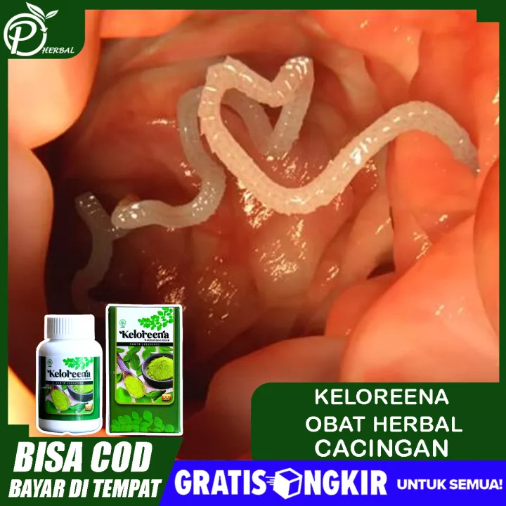 Detail Gambar Cacing Perut Nomer 14
