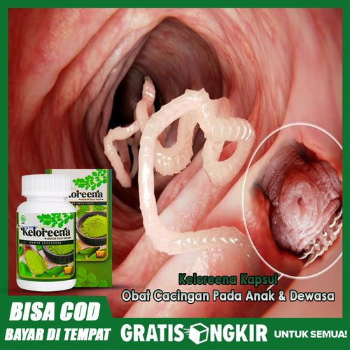 Detail Gambar Cacing Perut Pada Anak Cacing Perut Nomer 15