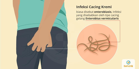 Detail Gambar Cacing Perut Pada Anak Cacing Perut Nomer 16