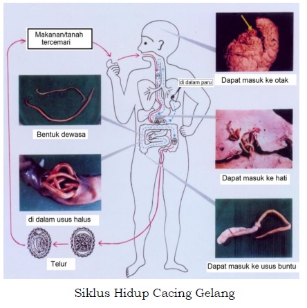 Detail Gambar Cacing Perut Pada Anak Cacing Perut Nomer 22