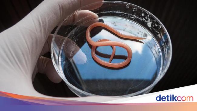Detail Gambar Cacing Perut Pada Anak Cacing Perut Nomer 32
