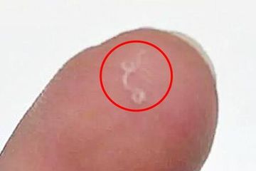 Detail Gambar Cacing Perut Pada Anak Cacing Perut Nomer 6