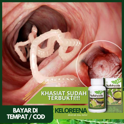 Detail Gambar Cacing Perut Pada Anak Cacing Perut Nomer 53