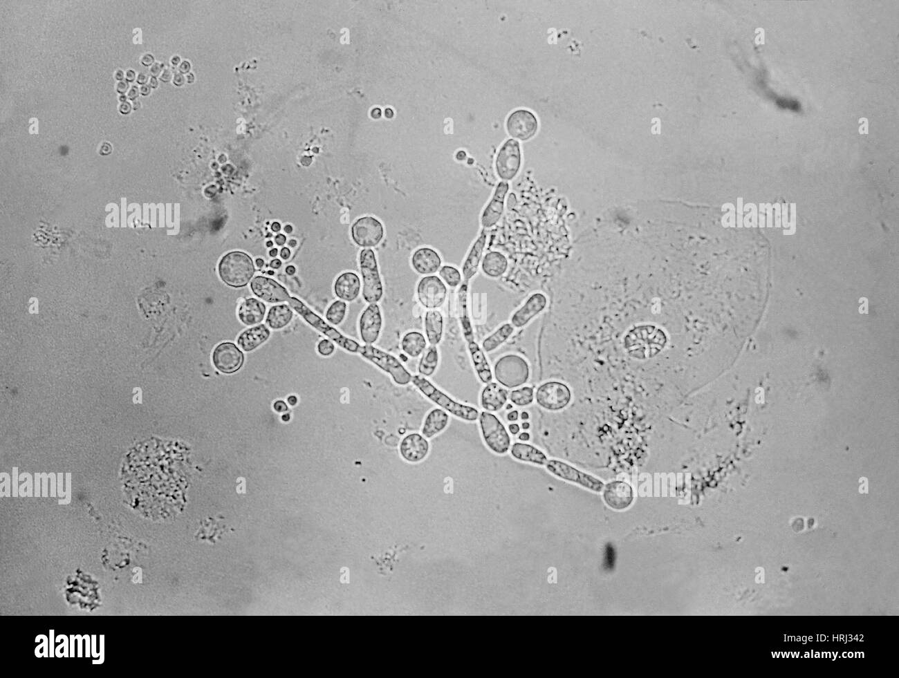 Detail Gambar Candida Albicans Nomer 16