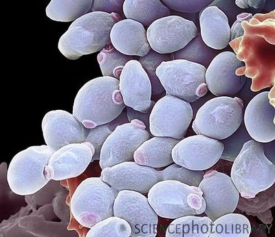 Detail Gambar Candida Albicans Nomer 19