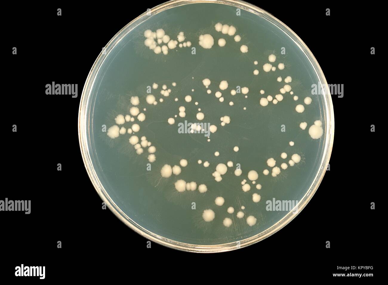 Detail Gambar Candida Albicans Nomer 22