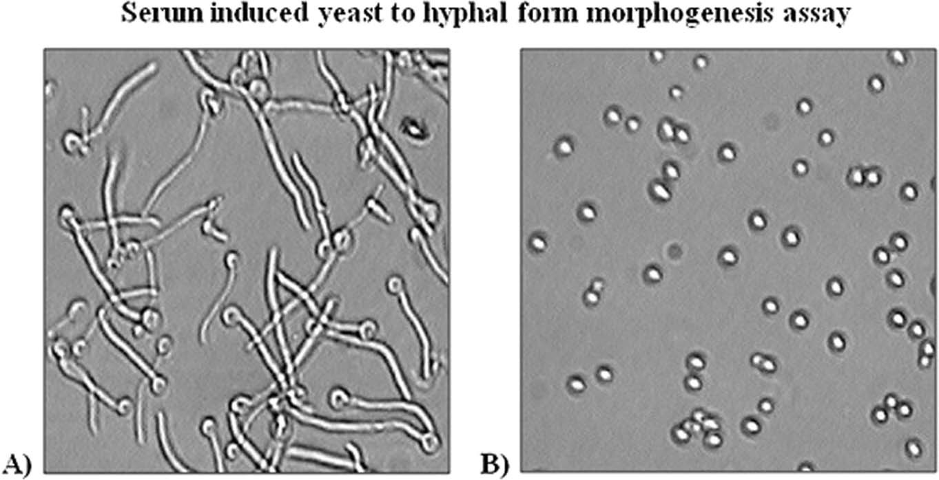 Detail Gambar Candida Albicans Nomer 26