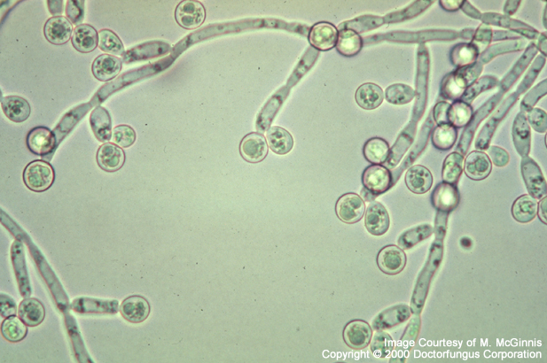 Detail Gambar Candida Albicans Nomer 4