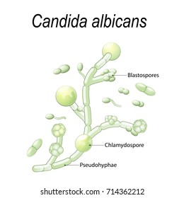 Detail Gambar Candida Albicans Nomer 5