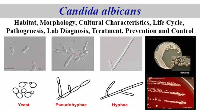 Detail Gambar Candida Albicans Nomer 41