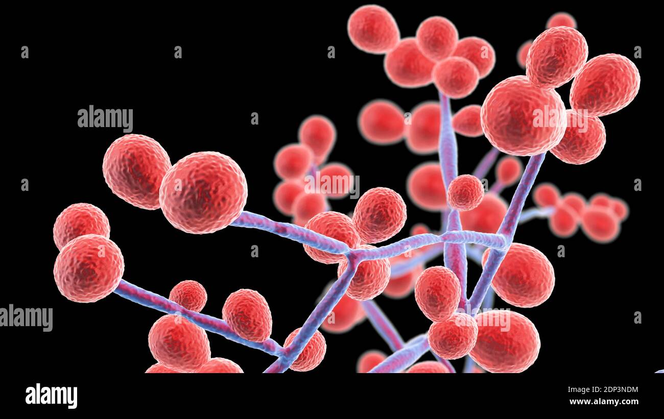 Detail Gambar Candida Albicans Nomer 46