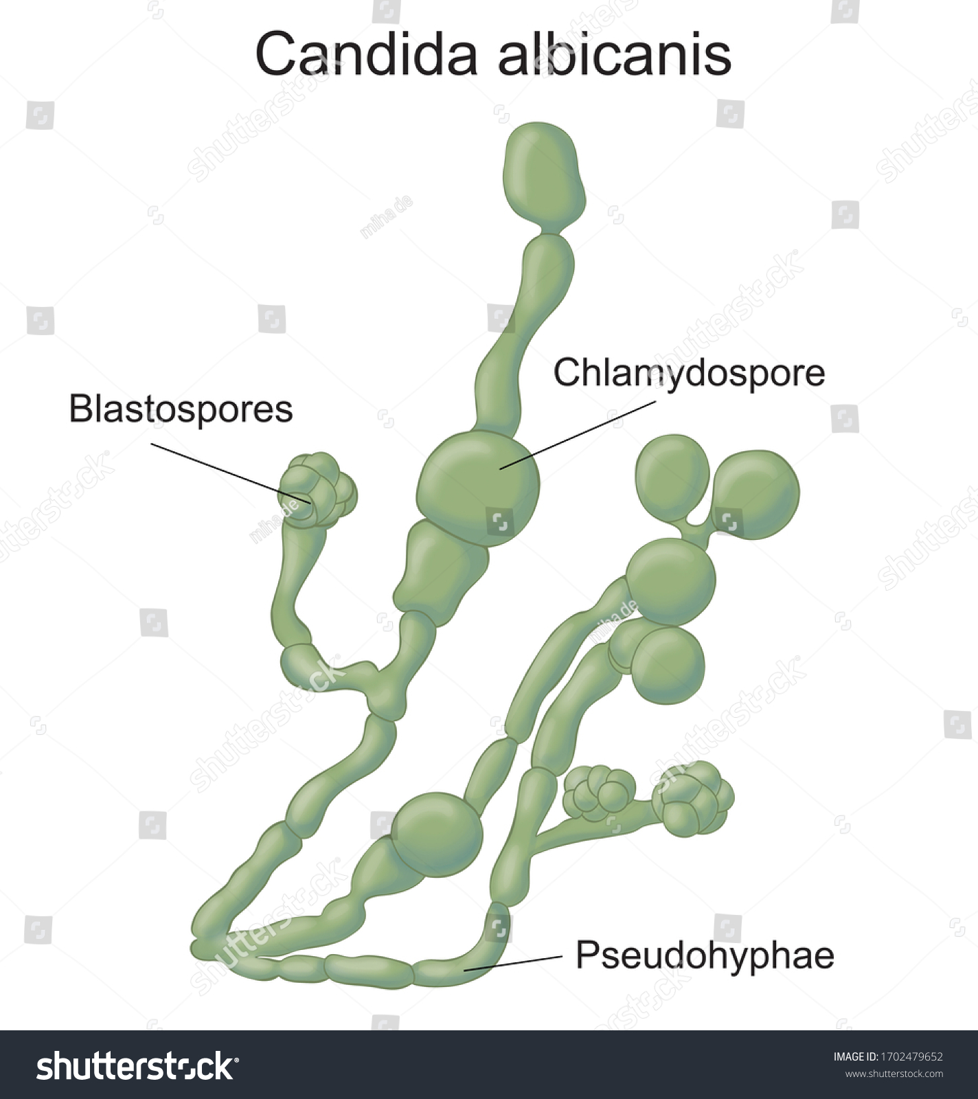 Detail Gambar Candida Albicans Nomer 8