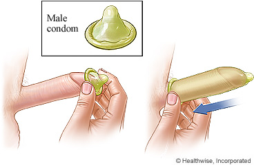 Detail Condom Use Pic Nomer 2