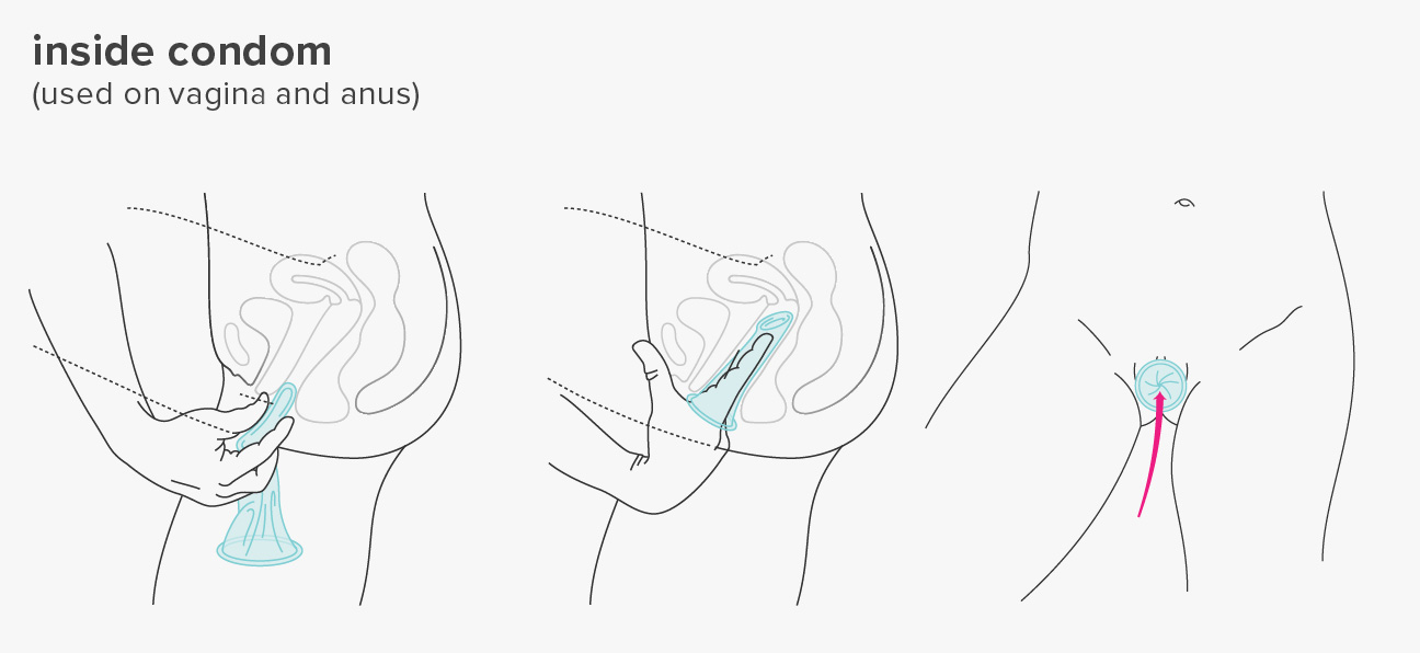 Detail Condom Use Pic Nomer 20