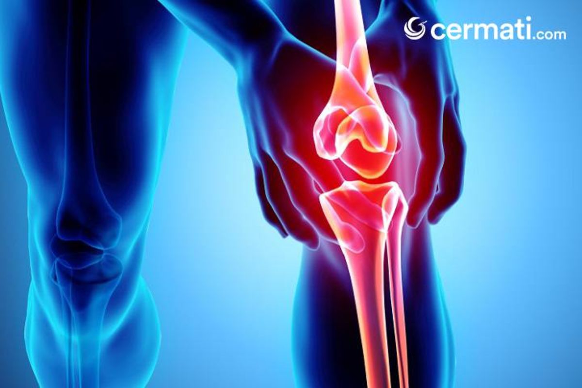 Gambar Cedera Lutut - KibrisPDR