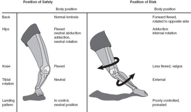 Detail Gambar Cedera Lutut Nomer 34