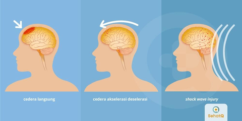 Detail Gambar Cedera Sel Yang Terjadi Dalam Penyakit Nomer 19