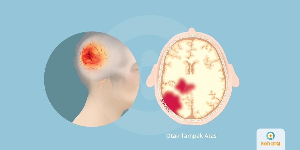 Detail Gambar Cedera Sel Yang Terjadi Dalam Penyakit Nomer 5