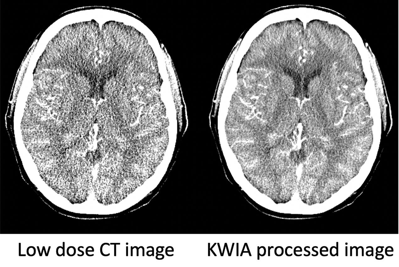 Detail Gambar Ct Scan Nomer 48