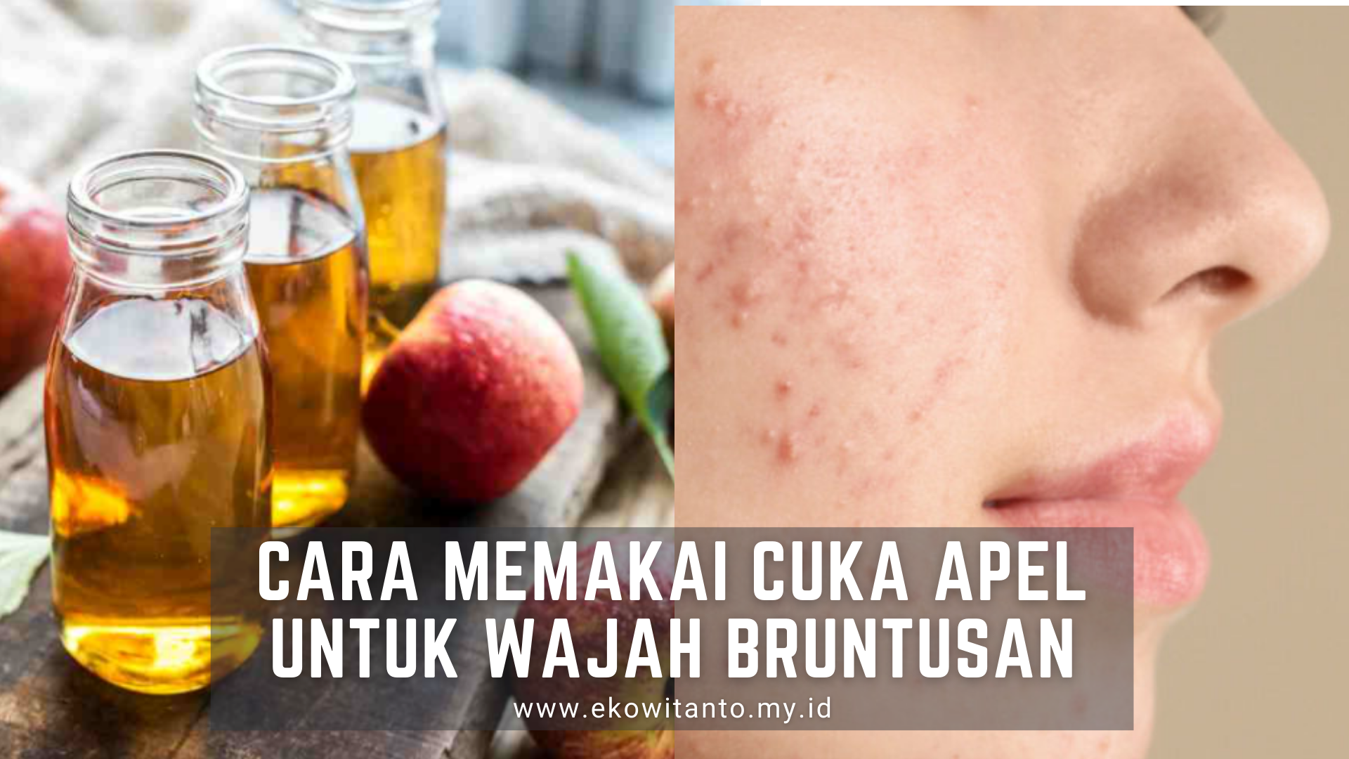 Detail Gambar Cuka Apel Untuk Wajah Nomer 50