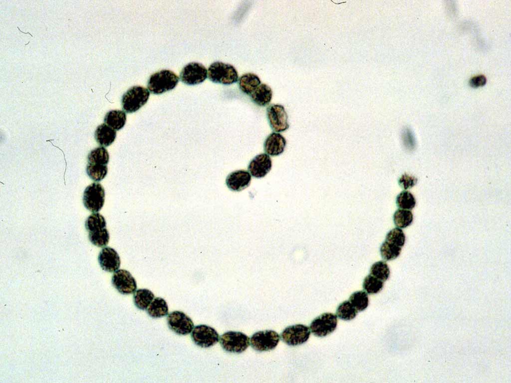 Detail Gambar Cyanobacteria Anabaena Azollae Nomer 9