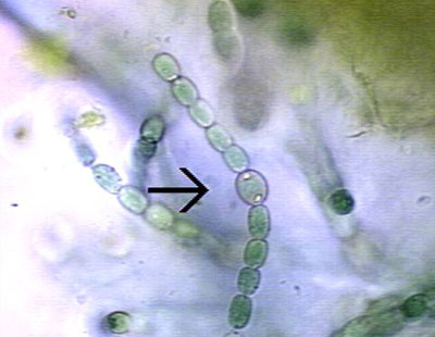 Detail Gambar Cyanobacteria Anabaena Azollae Nomer 34