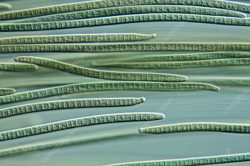 Gambar Cyanobacteria Oscillatoria - KibrisPDR