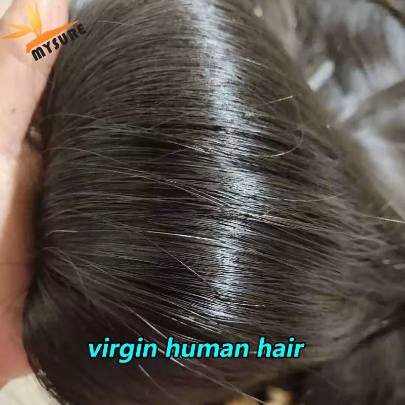 Detail Gambar Dahi Wanita Yang Virgin Nomer 38