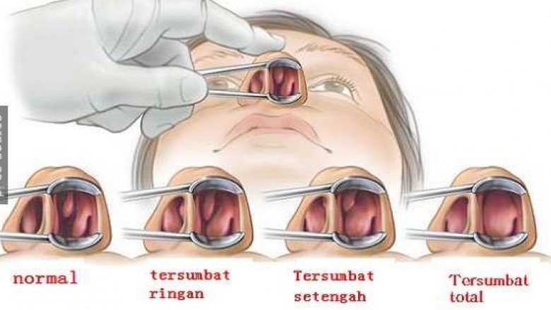 Detail Gambar Dalam Hidung Yang Sehat Nomer 2