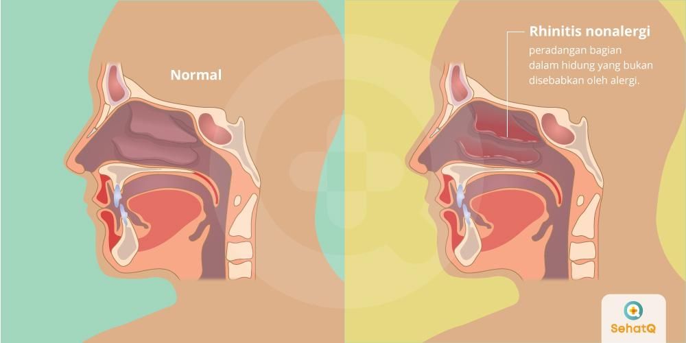 Detail Gambar Dalam Hidung Yang Sehat Nomer 21