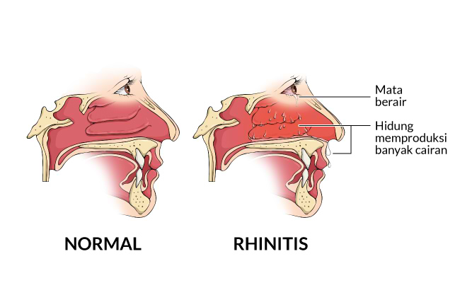 Detail Gambar Dalam Hidung Yang Sehat Nomer 53