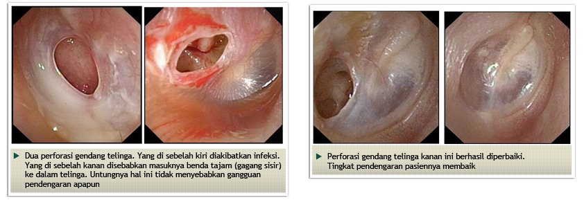 Detail Gambar Dalam Telinga Nomer 34