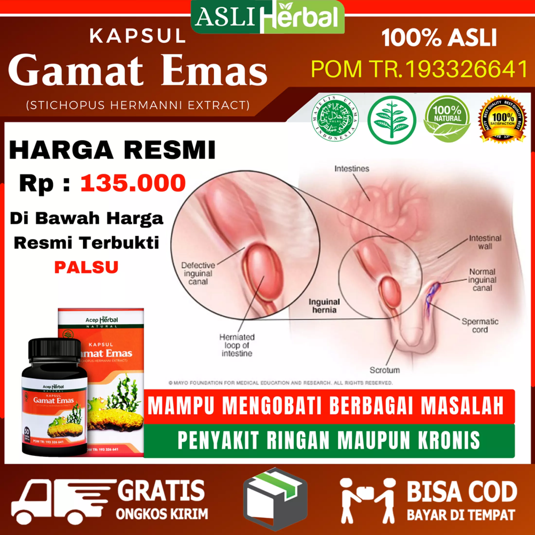Detail Gambar Dan Orkitis Nomer 43