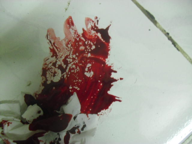 Detail Gambar Darah Di Lantai Nomer 30