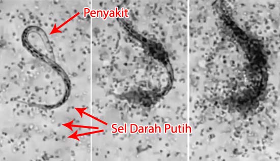 Detail Gambar Darah Gambar Darah Putih Nomer 13