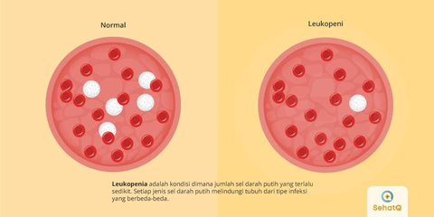 Detail Gambar Darah Gambar Darah Putih Nomer 48