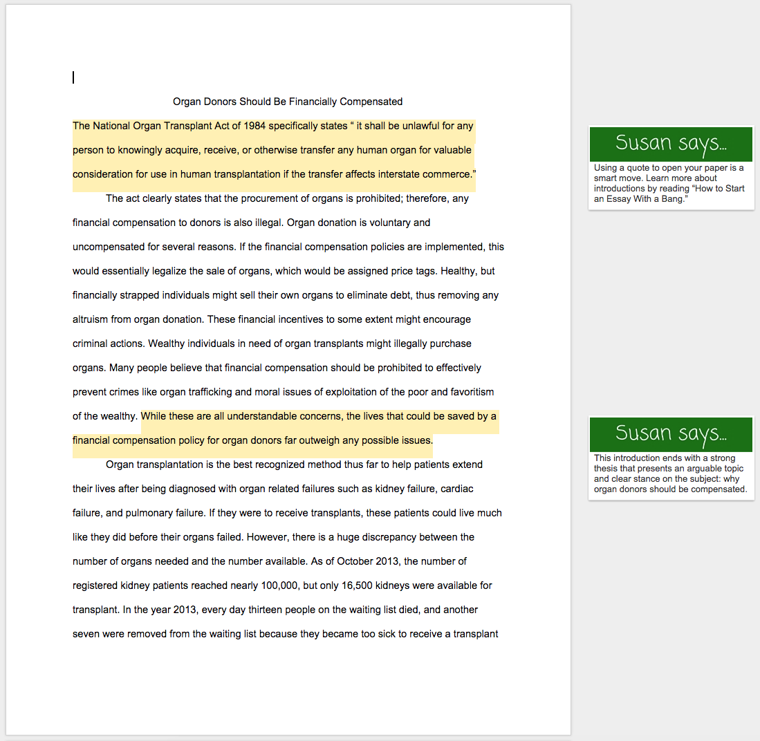 Detail Contoh Argumentative Text Nomer 31