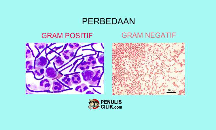 Detail Contoh Bakteri Gram Positif Nomer 15