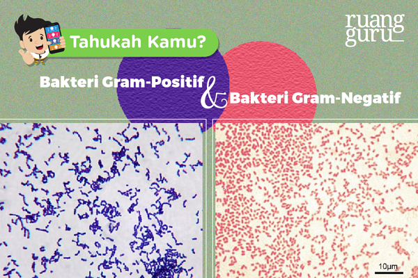 Detail Contoh Bakteri Gram Positif Dan Negatif Nomer 39