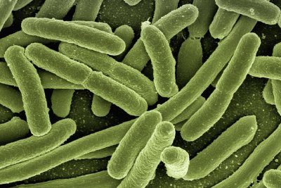 Detail Contoh Bakteri Parasit Nomer 20