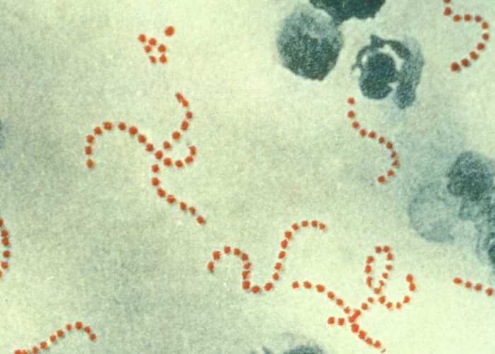 Detail Contoh Bakteri Streptococcus Nomer 2