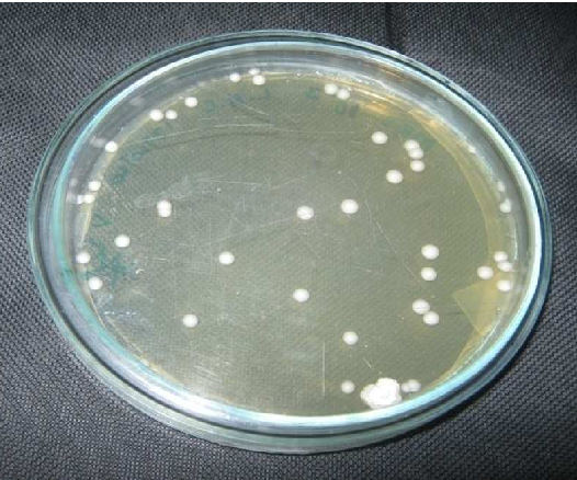 Detail Contoh Bakteri Streptococcus Nomer 43