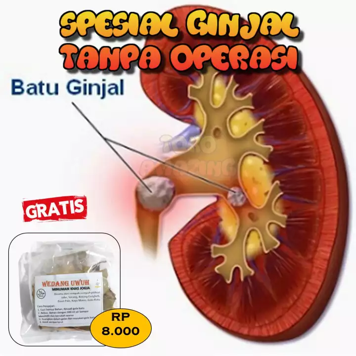 Detail Contoh Batu Ginjal Nomer 36